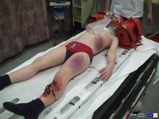 Reconocimiento secundario.
 