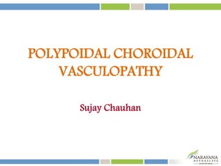POLYPOIDAL CHOROIDAL
VASCULOPATHY
Sujay Chauhan
 