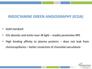 INDOCYANINE GREEN ANGIOGRAPHY (ICGA)
• Gold standard
• ICG absorbs and emits near-IR light – readily penetrates RPE
• High binding affinity to plasma proteins – does not leak from
choriocapillaries – better resolution of choroidal vasculature
 