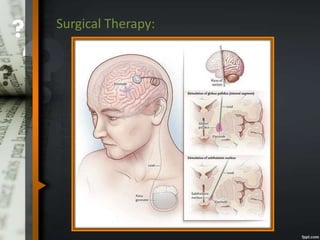 Surgical Therapy:
 