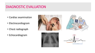 DIAGNOSTIC EVALUATION
• Cardiac examination
• Electrocardiogram
• Chest radiograph
• Echocardiogram