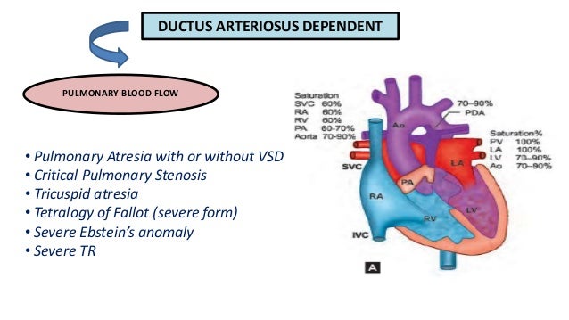 Ductus dependent circulation