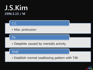 J.S.Kim
1996.5.15 / M


    C.C

    • Max. protrusion

    Dx

    • Deepbite caused by mentalis activity

    Goal

    • Establish normal swallowing pattern with T4K
 