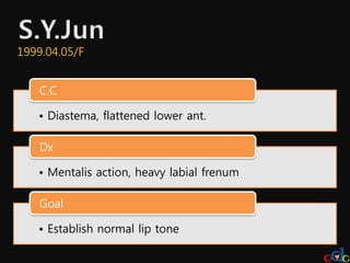 1999.04.05/F


   C.C

   • Diastema, flattened lower ant.

   Dx

   • Mentalis action, heavy labial frenum

   Goal

   • Establish normal lip tone
 