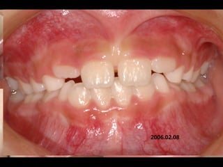 2006.02.08
 2004.05.13
 