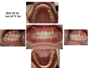 2012 02 01
out of Tr 2yr
 