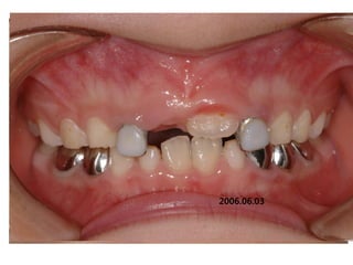 2006.06.03
      2005.08.27
      .
 