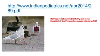 http://www.indianpediatrics.net/apr2014/2
89.pdf
Marriage is not always that funny as it looks
Especially if the Preterm has cursed with large PDA
 