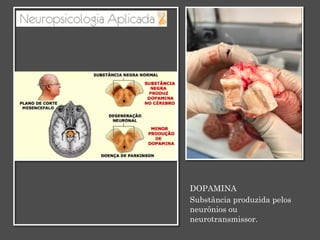 DOPAMINA
Substância produzida pelos
neurônios ou
neurotransmissor.
 