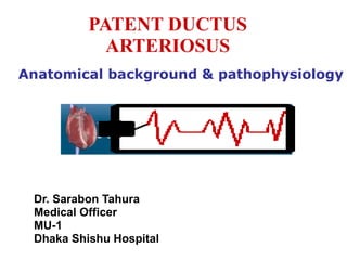 PATENT DUCTUS ARTERIOSUS ,[object Object],[object Object],[object Object],[object Object],Anatomical background & pathophysiology 