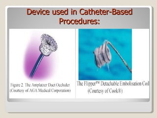 Device used in Catheter-Based Procedures: 