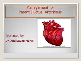 Dr. Abu Sayed Munsi Management  of Patent Ductus  Arteriosus Presented by 