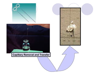 Capillary Removal and Transfer 