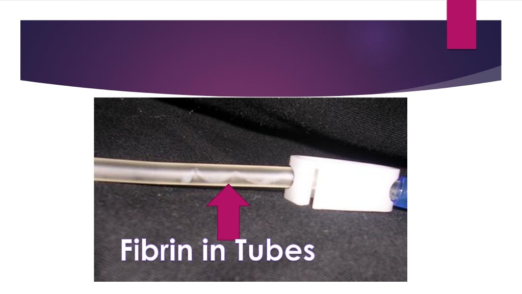 Peritoneal dialysis catheter dysfunction