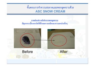 ASC SNOW CREAM

         กF   -    ก   ก
ˆ   ก    ก     F       ก   ก ก




Before                     After
 