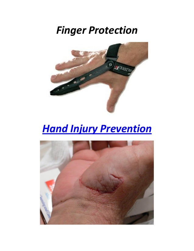 Hammer Guard Safety Protection