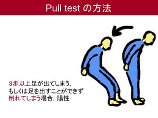 pullテスト パーキンソン病 – pull test 姿勢反射障害 – KFSWCU