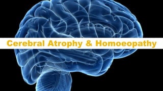 Cerebral Atrophy & Homoeopathy