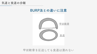 気道と食道の分離
BURP法との違いに注意
甲状軟骨
食道
甲状軟骨を圧迫しても食道は潰れない
 