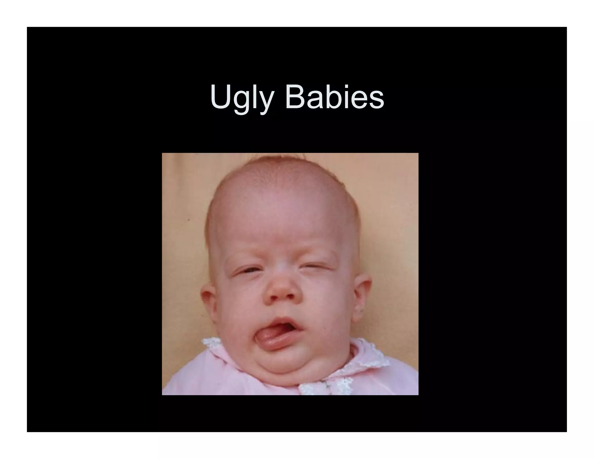 Ugly Babies
 