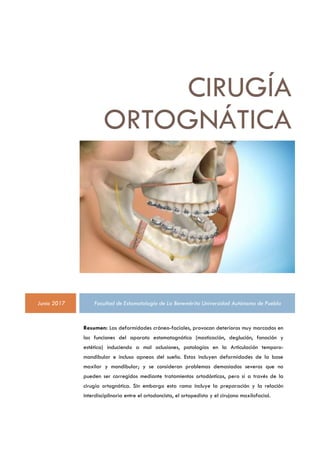 Prognatismo Mandibular o Clase 3 » Cirugía Ortognática - Instituto