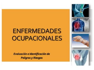 ENFERMEDADES
ENFERMEDADES
OCUPACIONALES
OCUPACIONALES
Evaluación e Identificación de
Evaluación e Identificación de
Peligros y Riesgos
Peligros y Riesgos
 