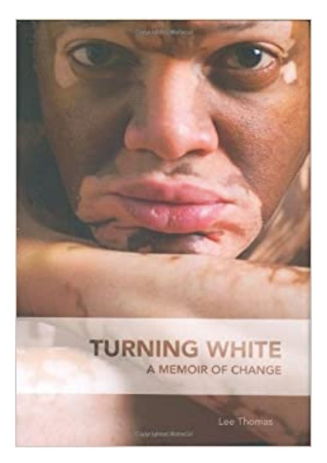 Pdf Free Turning White A Memoir Of Change Free Acces