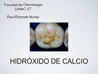 Facuitad de Odontologia
UAdeC UT
Raul Elizondo Nunez
HIDROXIDO DE CALCIO
 