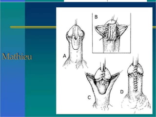 Mathieu
 