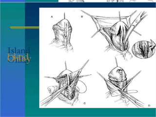 I
O
s
l
n
a
l
n
a
d
y
 