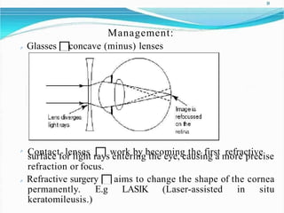 18
Management:
Glasses concave (minus) lenses
Contact lenses work by becoming the first refractive
surface for light rays entering the eye, causing a more precise
refraction or focus.
Refractive surgery aims to change the shape of the cornea
permanently. E.g LASIK (Laser-assisted in situ
keratomileusis.)
 
