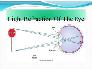 Light Refraction Of The Eye
6
 