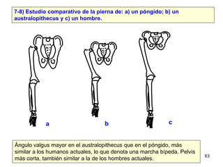 7-8) Estudio comparativo de la pierna de: a) un póngido; b) un
australopithecus y c) un hombre.




            a         ...