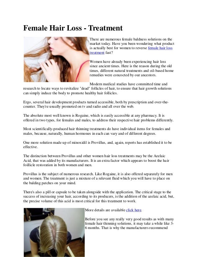 Female Hair Loss Treatment