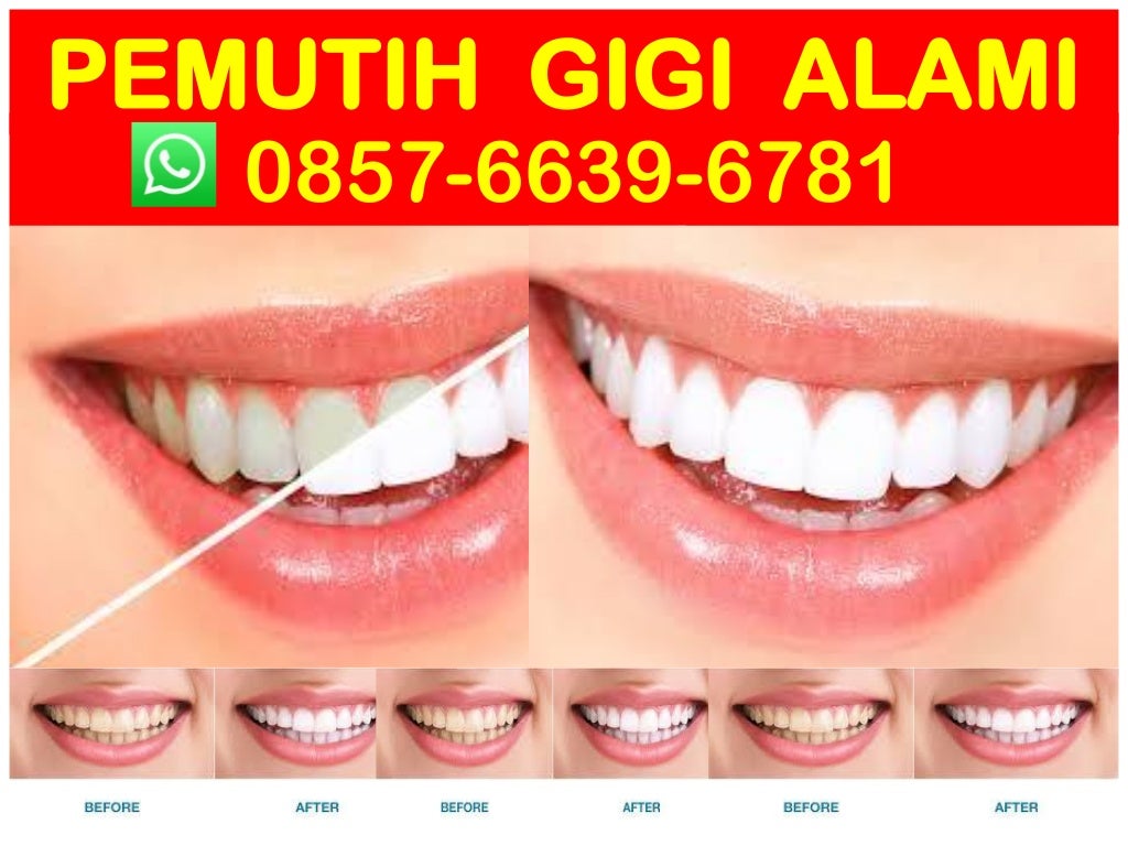 produk pemutih gigi