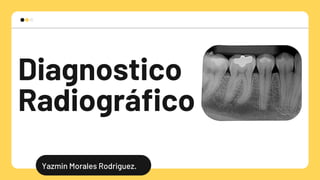 Diagnostico
Radiográfico
Yazmin Morales Rodriguez.
 