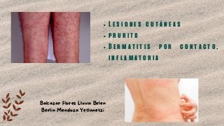 Lesiones cutáneas
prurito
Dermatitis por contacto,
inflamatoria
Balcazar Flores Lluvia Belen
Berlin Mendoza Yetlanetzi
 
