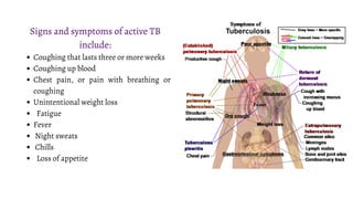 Coughing that lasts three or more weeks
Coughing up blood
Chest pain, or pain with breathing or
coughing
Unintentional weight loss
Fatigue
Fever
Night sweats
Chills
Loss of appetite
Signs and symptoms of active TB
include:
 