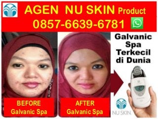 AGEN NU SKIN Product
0857-6639-6781
BEFORE
Galvanic Spa
AFTER
Galvanic Spa
 