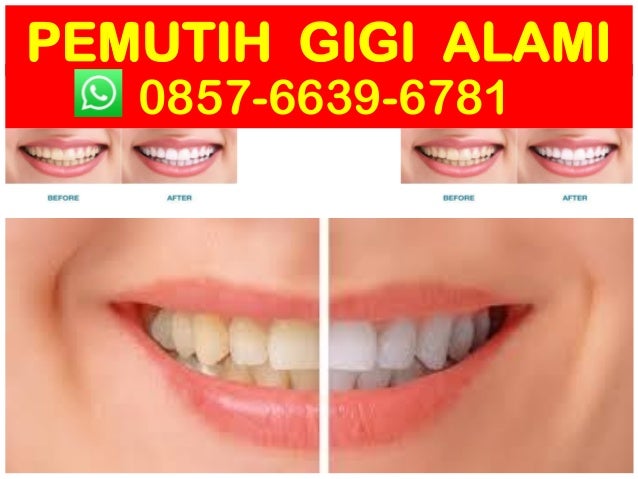 hub 0857 6639 6781 wa pemutih gigi alami pemutih gigi hub 0857 6639 6781 wa pemutih gigi alami pemutih gigi