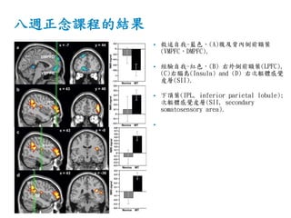 八週正念課程的結果
• 敘述自我-藍色，(A)腹及背內側前額葉
(VMPFC，DMPFC),
• 經驗自我-紅色，(B) 右外側前額葉(LPFC),
(C)右腦島(Insula) and (D) 右次軀體感覺
皮層(SII).
• 下頂葉(IPL, inferior parietal lobule);
次軀體感覺皮層(SII, secondary
somatosensory area).
•
 