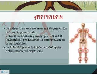 Pdf artrosis