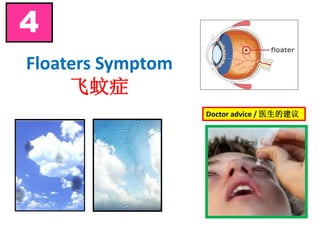 Floaters Symptom
飞蚊症
4
Doctor advice / 医生的建议
 