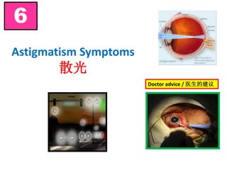 Astigmatism Symptoms
散光
6
Doctor advice / 医生的建议
 
