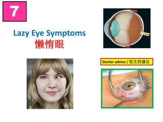 Lazy Eye Symptoms
懒惰眼
7
Doctor advice / 医生的建议
 