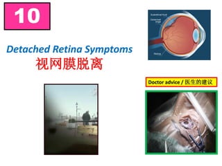 Detached Retina Symptoms
视网膜脱离
10
Doctor advice / 医生的建议
 