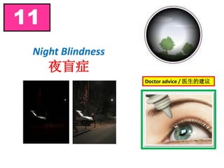 Night Blindness
夜盲症
11
Doctor advice / 医生的建议
 