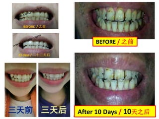 After 10 Days / 10天之后
BEFORE / 之前
 