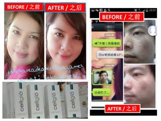 BEFORE / 之前 AFTER / 之后
AFTER / 之后
BEFORE / 之前
 