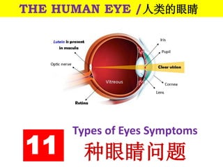 Types of Eyes Symptoms
种眼睛问题
THE HUMAN EYE /人类的眼睛
11
 